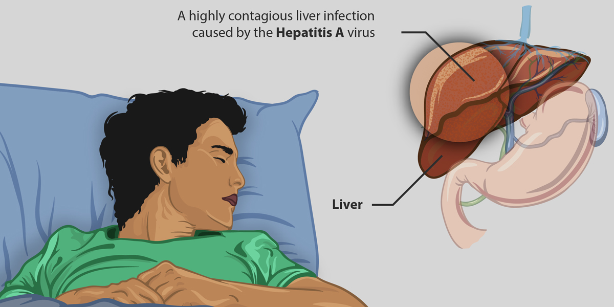 hepatitis a virus