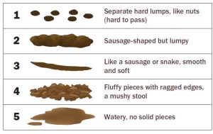 Illustration of stool consistency rated 1 to 5